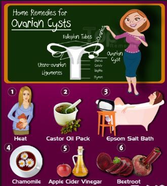 Natural Cure for Ovarian Cyst